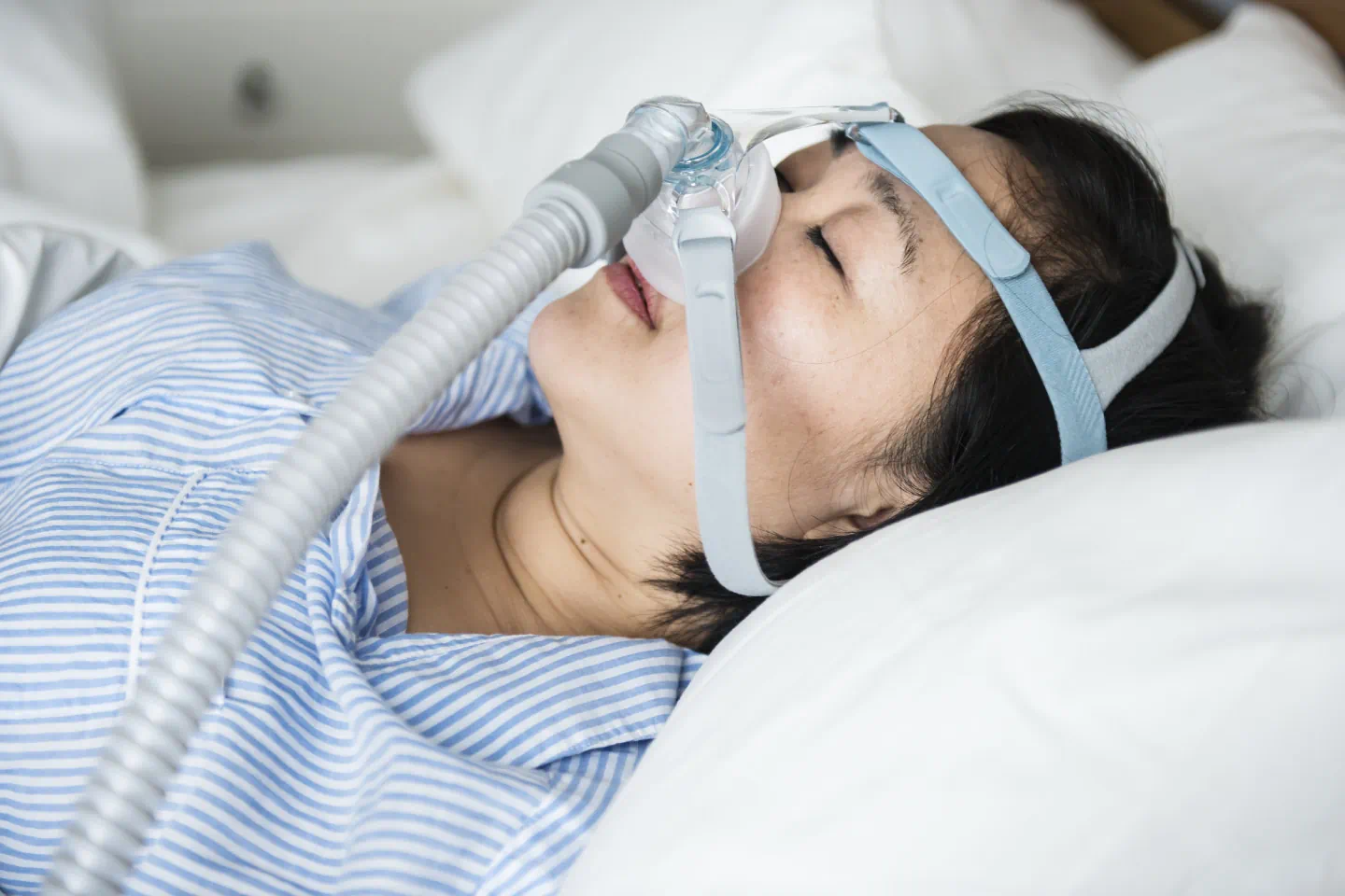 Sleep Apnea