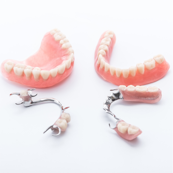 Tooth Replacement
