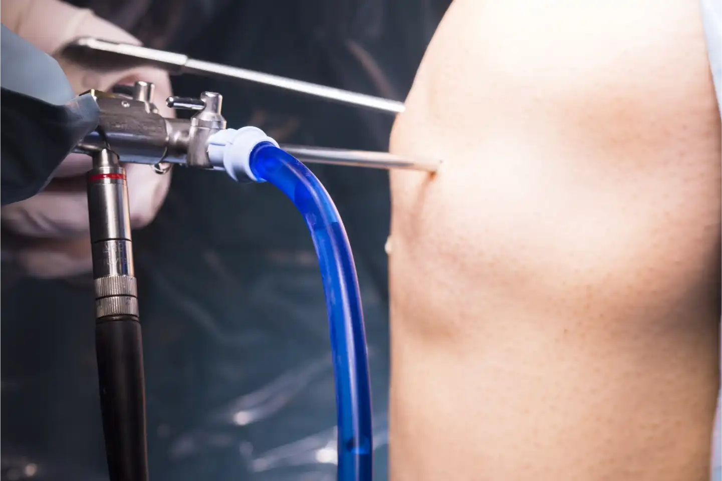 Orthopaedic Surgery
