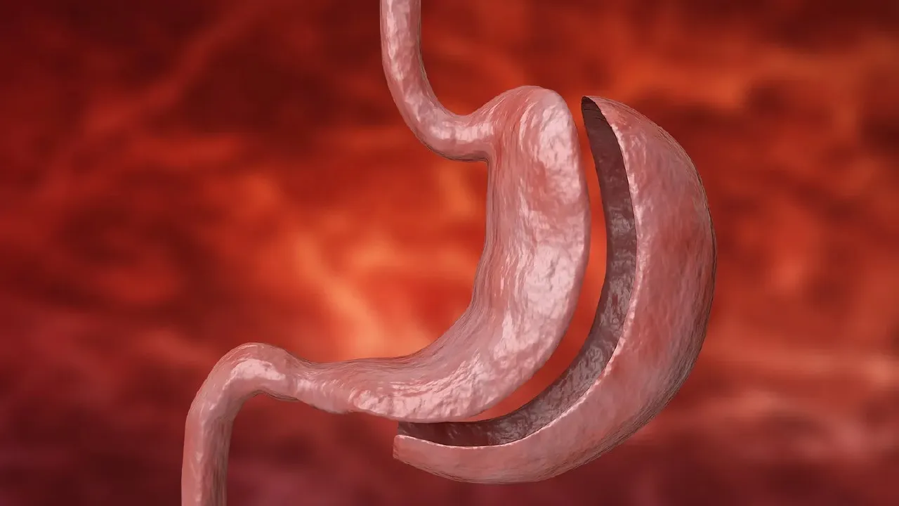 Doctor counseling a bariatric surgery patient about weight regain and healthy lifestyle habits