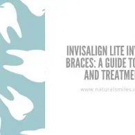 Invisalign Lite Invisible Braces: A Guide to Costs and Treatment