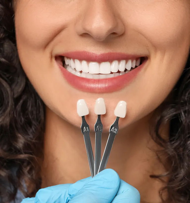 What Are The Advantages Of Porcelain Veneers?