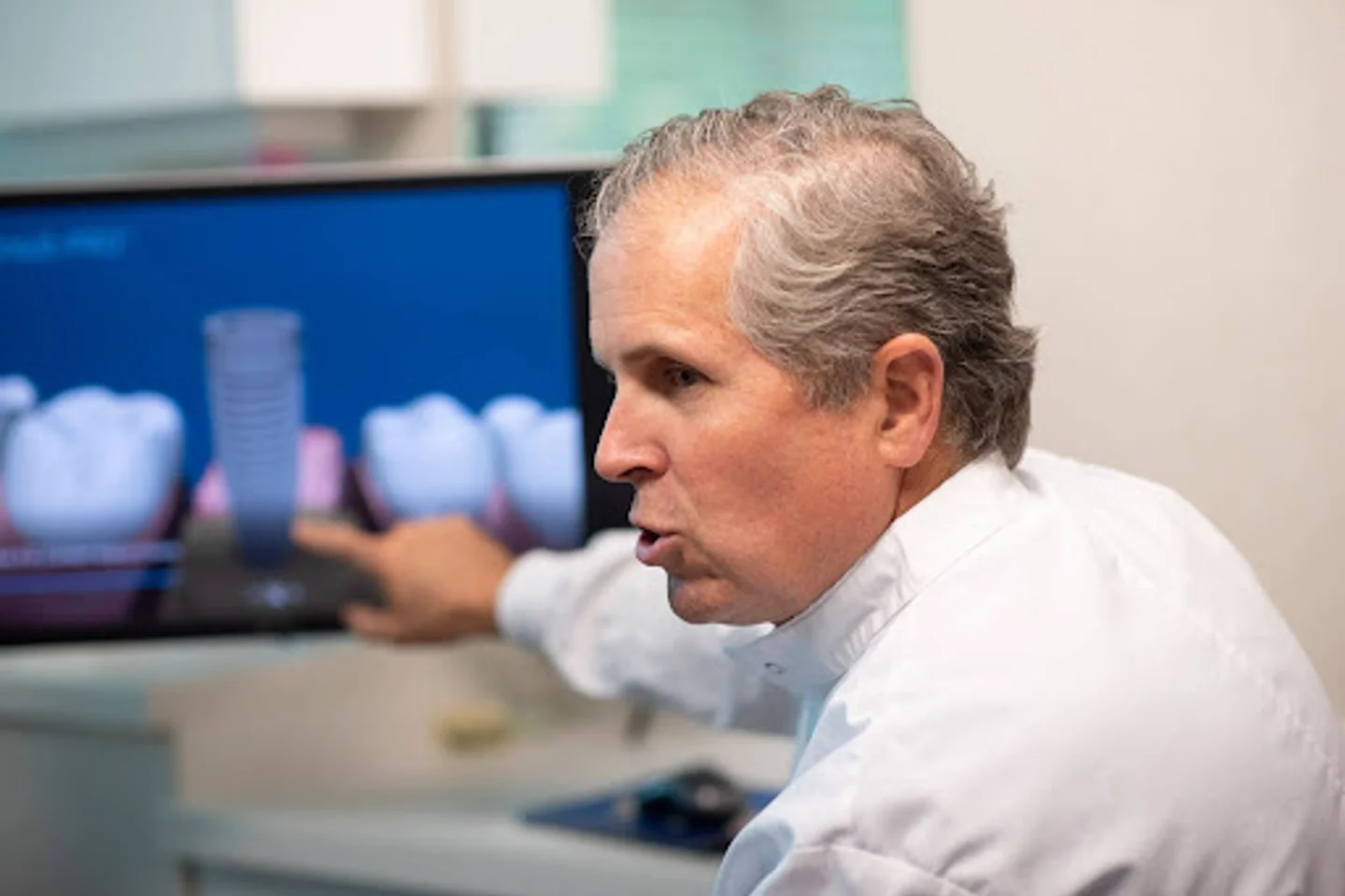 Top Cause of Dental Implant Failure and Prevention