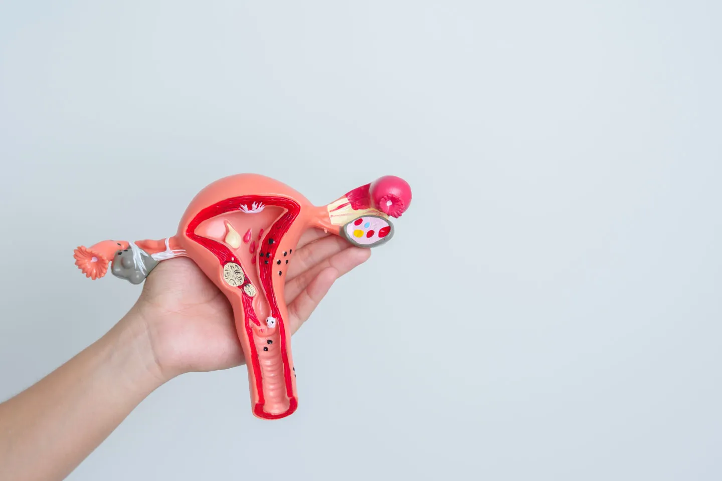 Unravel the Mystery of Fibroids