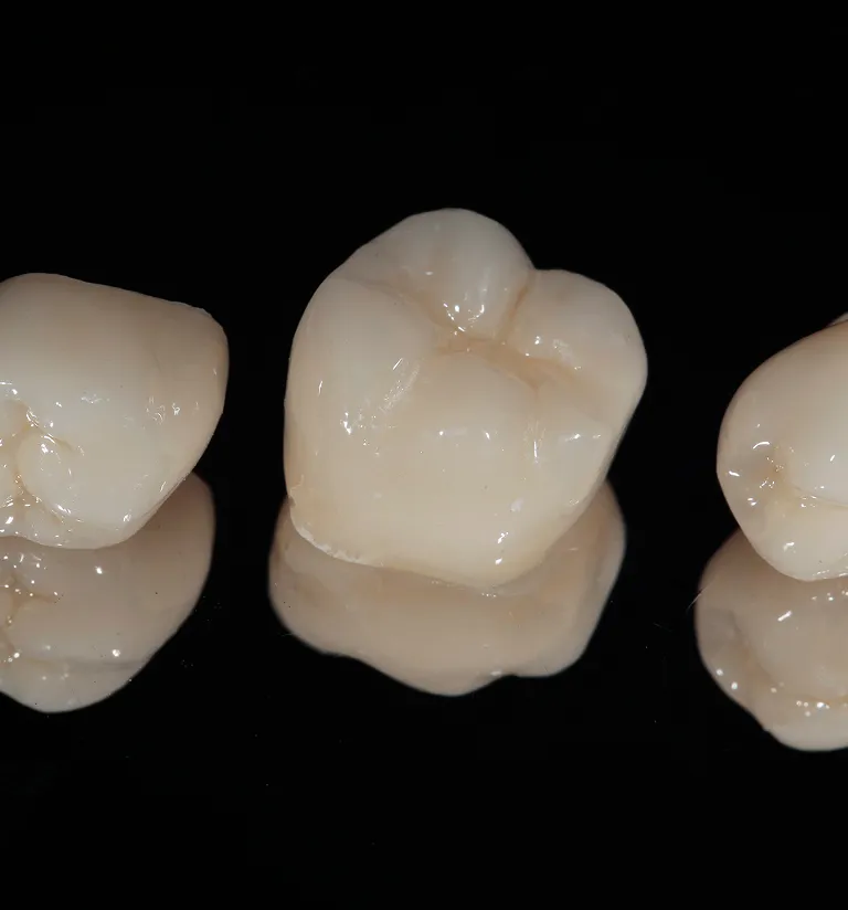 Who Is A Good Candidate For Dental Crowns?