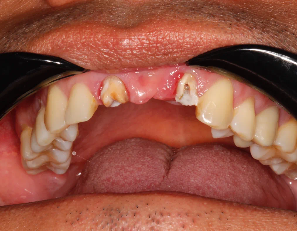 Emergency Dentist