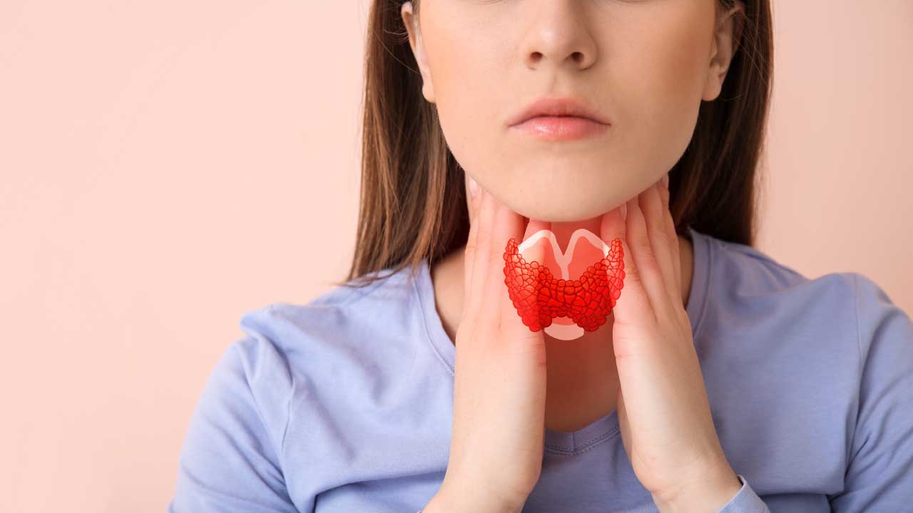 Overactive Thyroid Condition Illustration