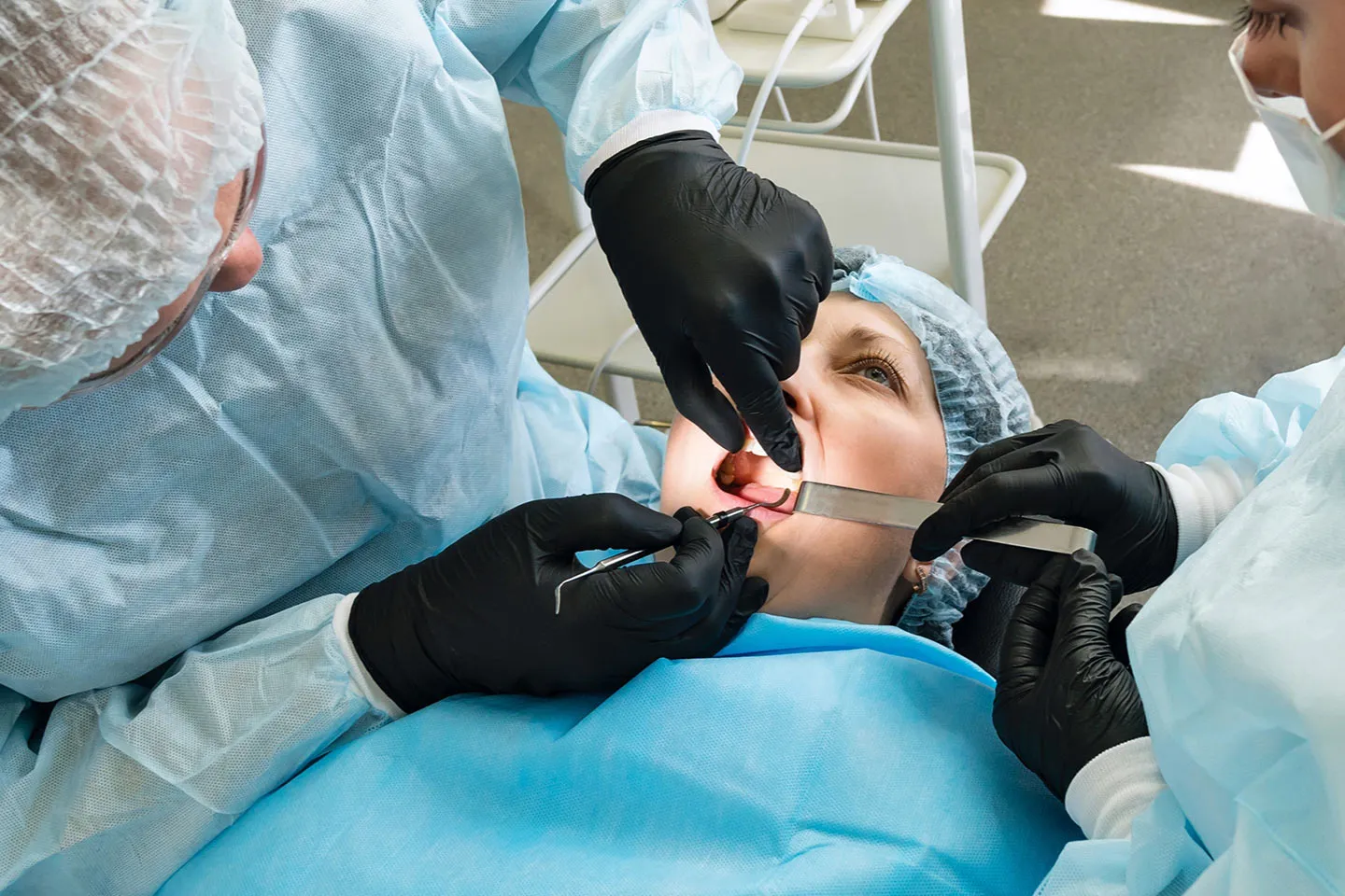 Everything You Need to Know about Emergency Tooth Extractions