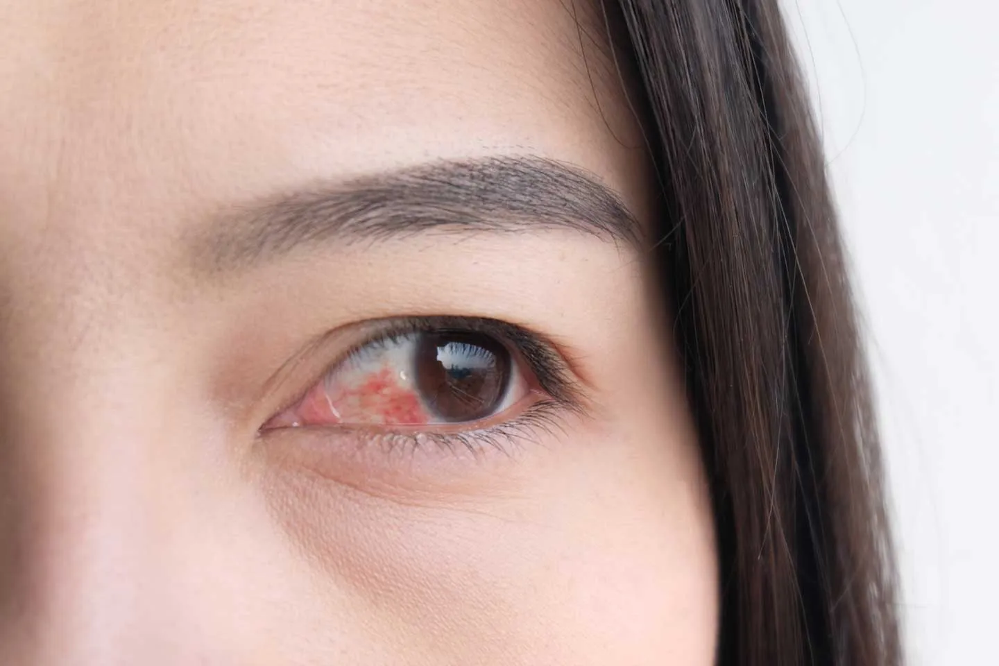 8 Tips to Relieve Winter Dry Eyes