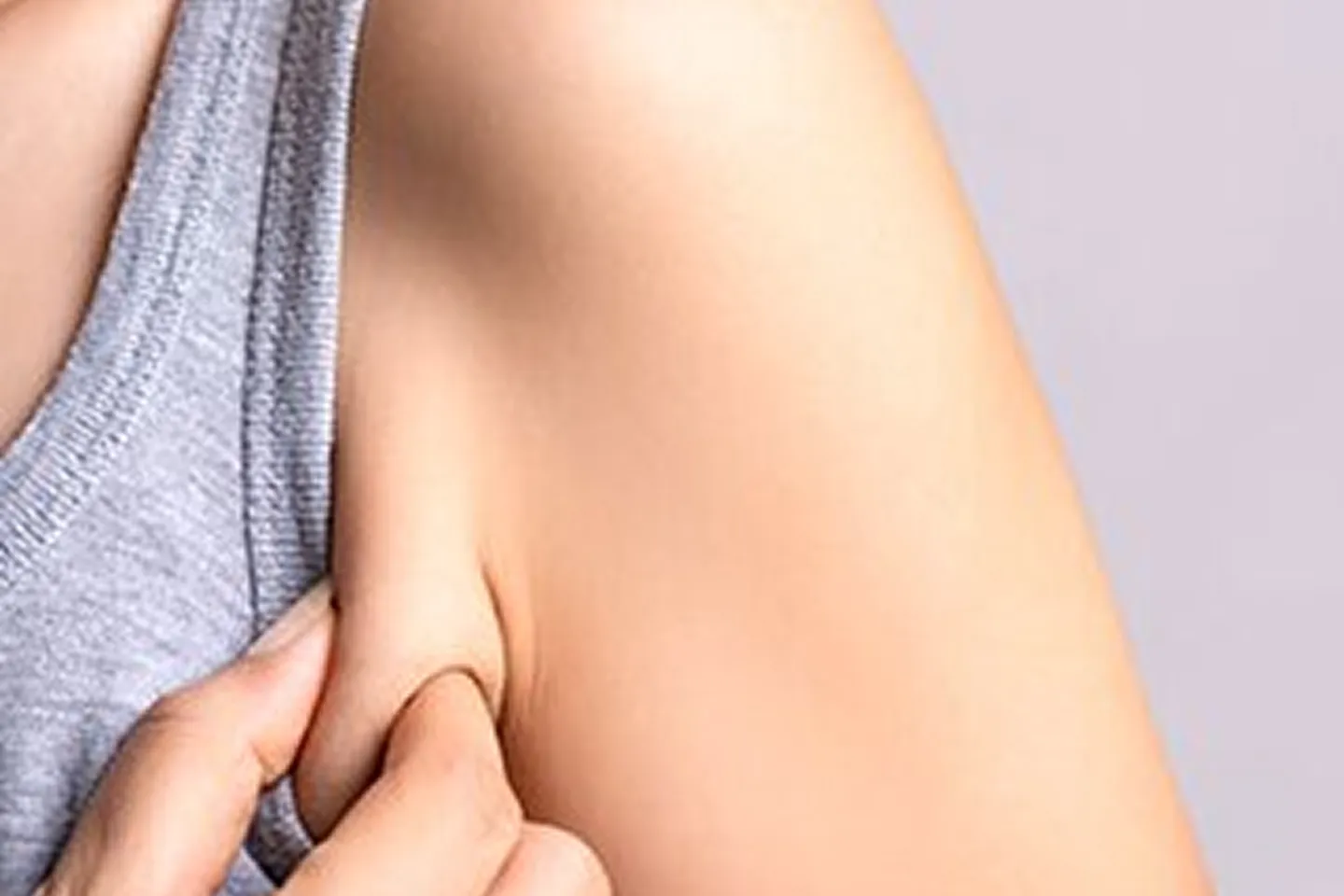 Accessory Breast Tissue Example