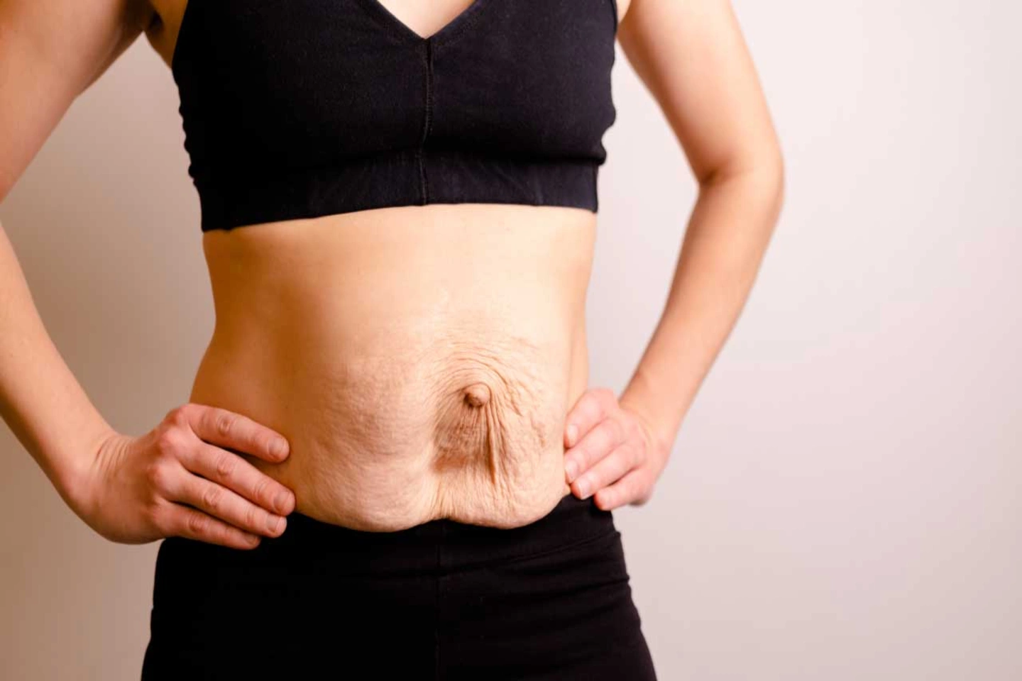 Understanding Hernia: Causes, Symptoms, and Advanced Treatment Options