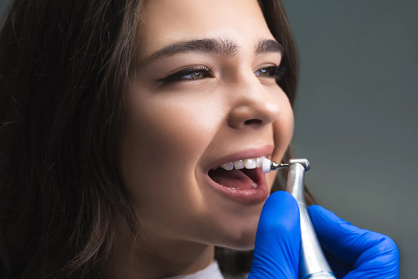 Professional Teeth Cleanings at Ripon Dental in California