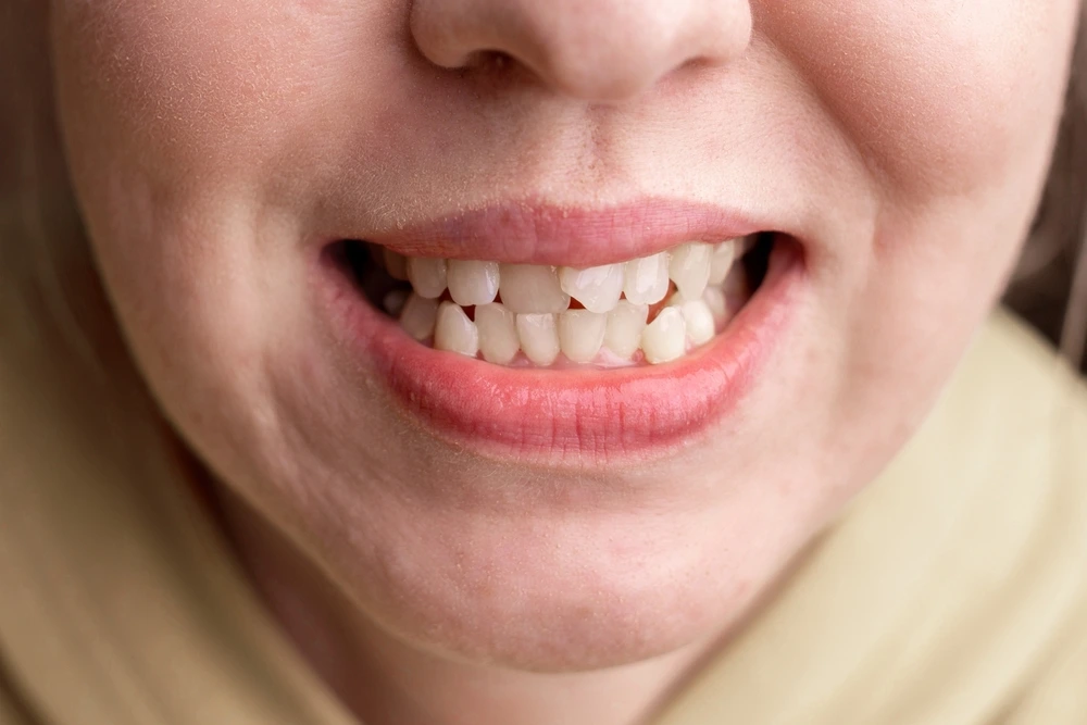 Crooked Tooth