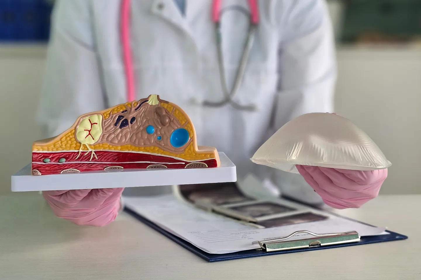 Implant-Based Reconstruction (Autologous Local Flap)