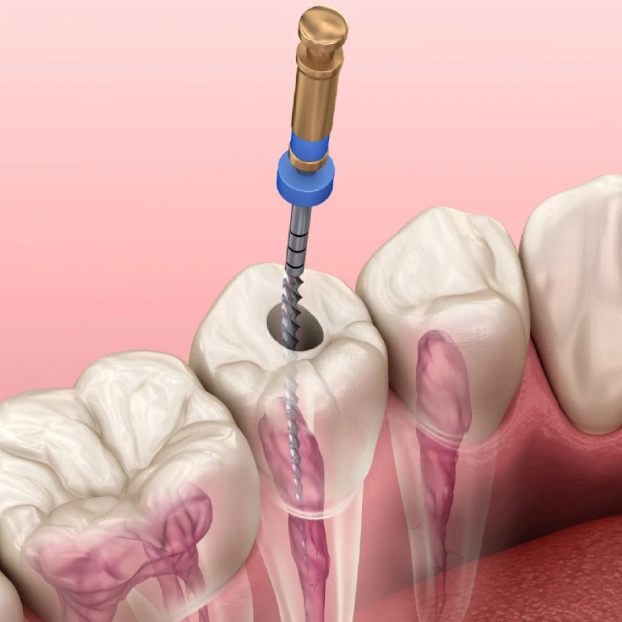 Restorative Dentistry