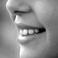 5 Things You Should Know About Dental Implants