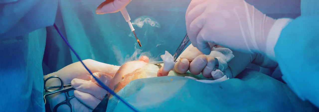 Lumpectomy + Sentinel Lymphnode Biopsy