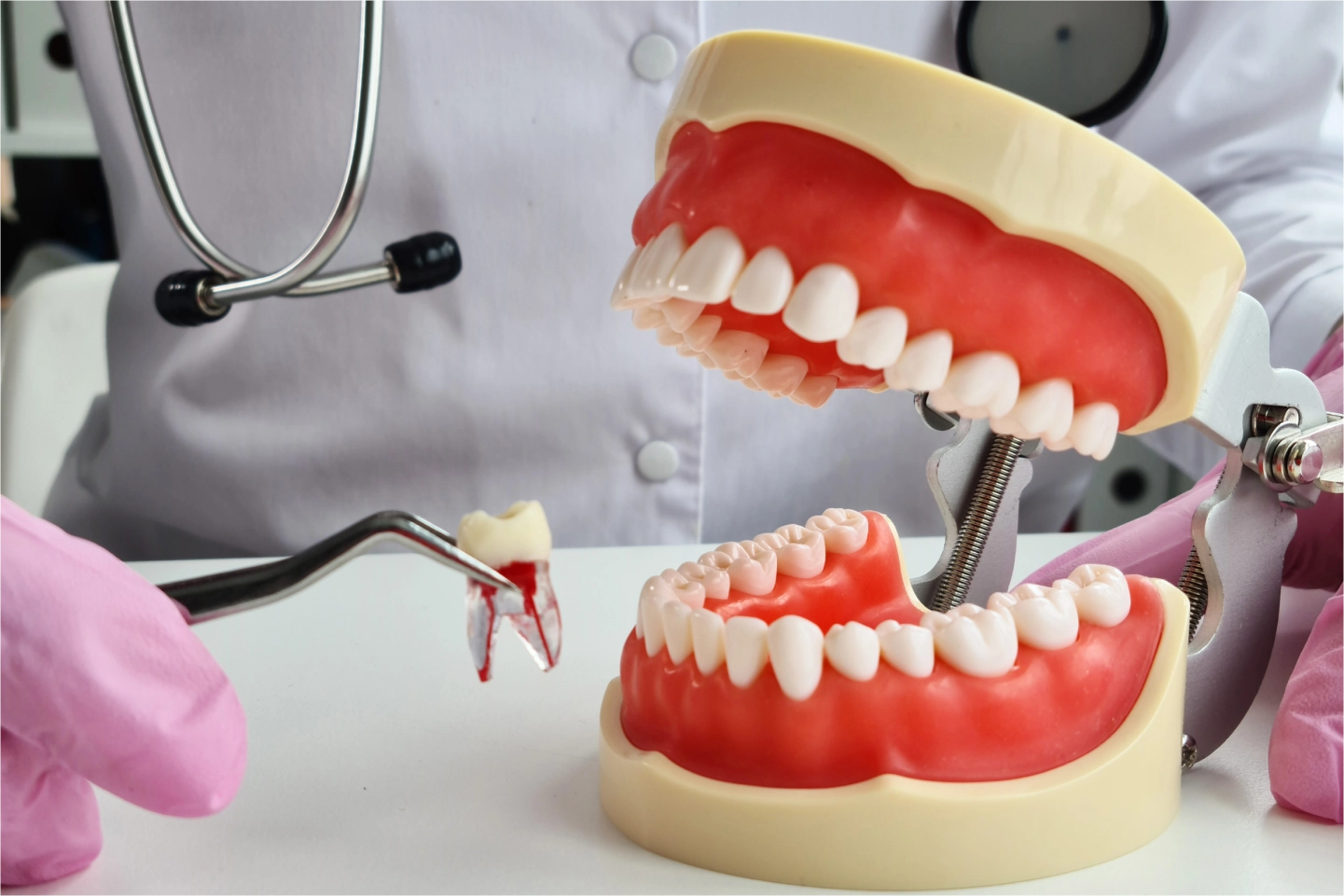 When Is a Tooth Extraction Necessary