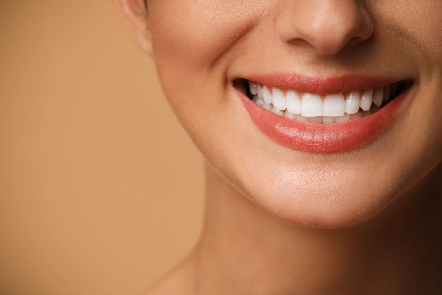 Bright smile showing results of dental veneers or bonding treatment.