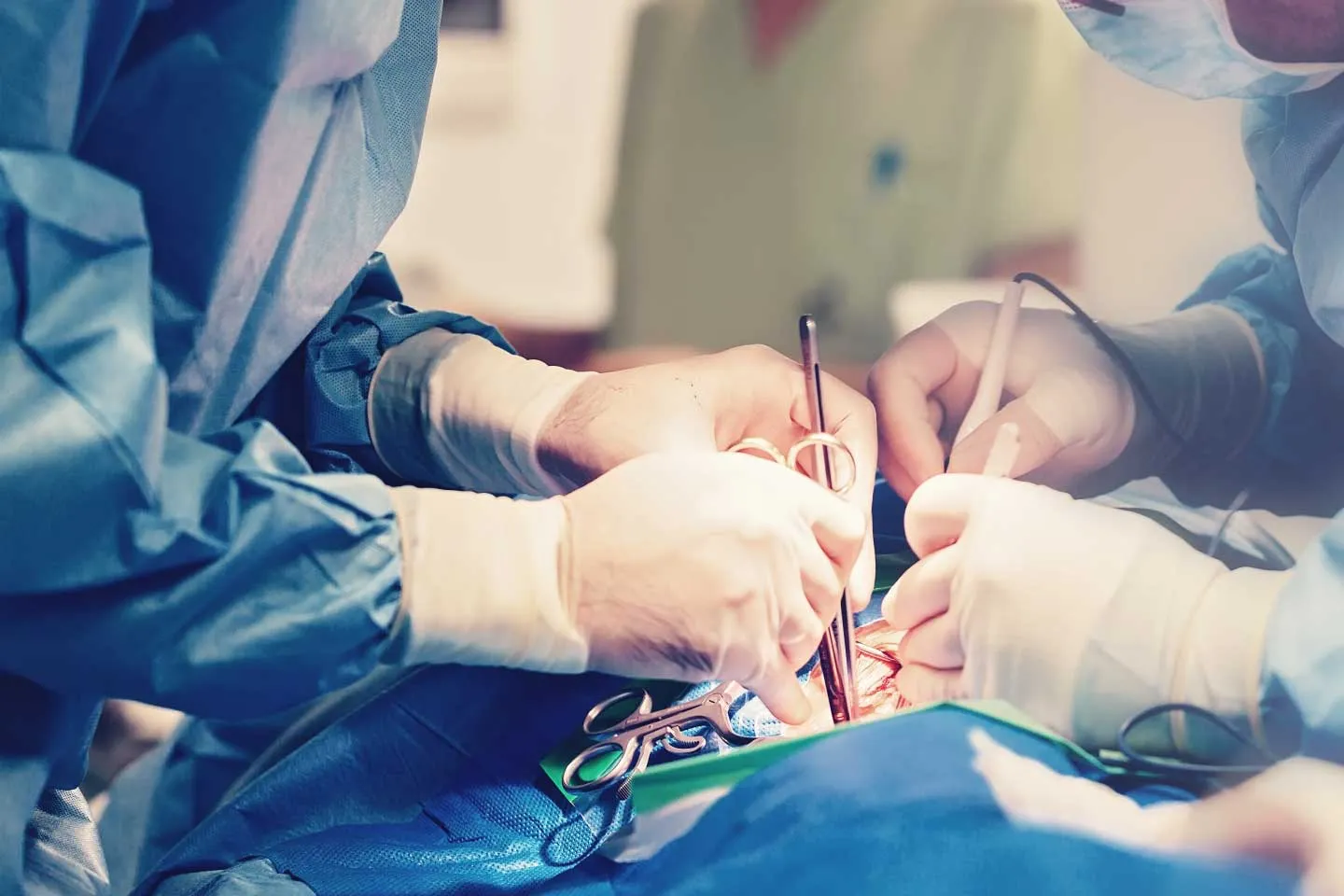 Laparoscopic vs. Open Surgery: Which is Better for You?