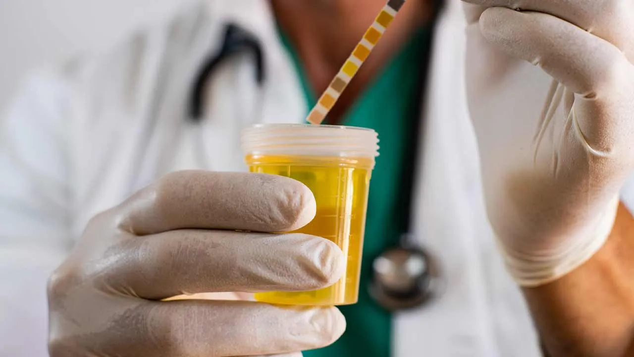 Kidney Diagram Highlighting Protein Leakage Mechanism.
