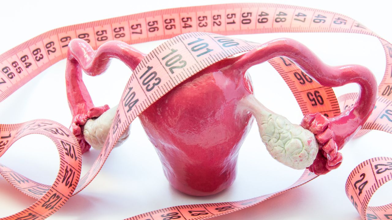 Uterus With Fibroid Illustration And Laparoscopic Surgery Icon