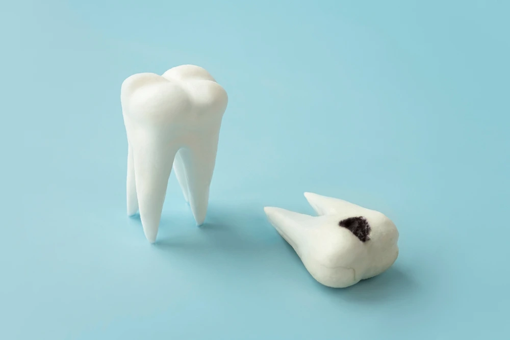 Damaged Tooth