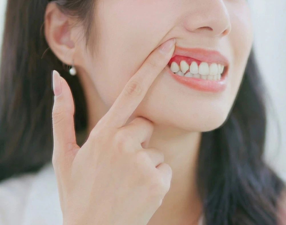 Periodontal (Gum) Care