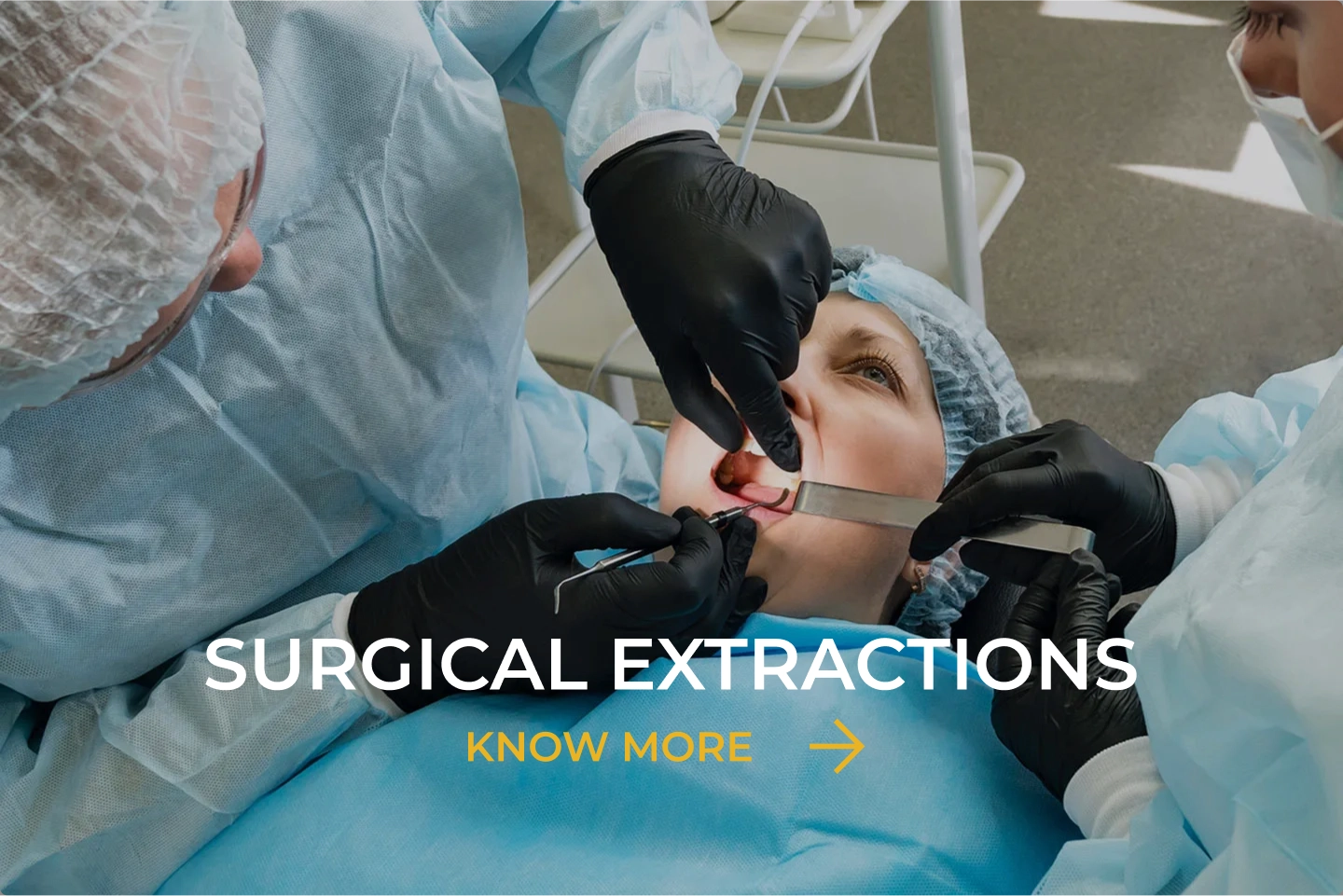 Surgical Extraction