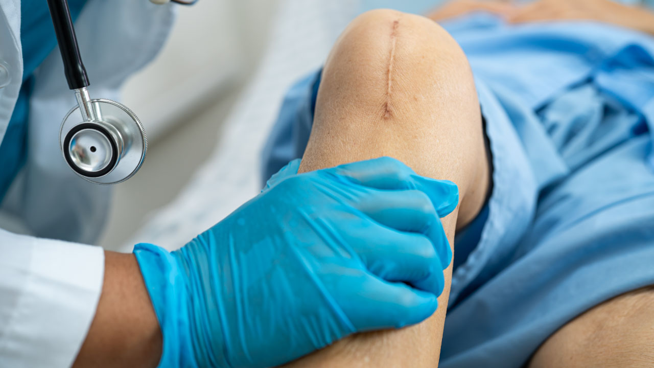 Thinking About Joint Replacement? Key Indicators to Know