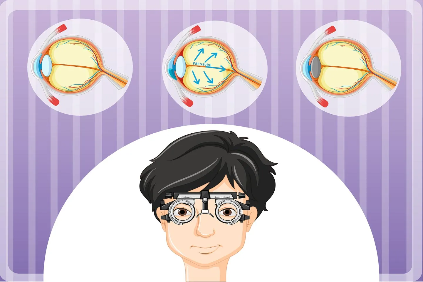 Rising Levels of Myopia