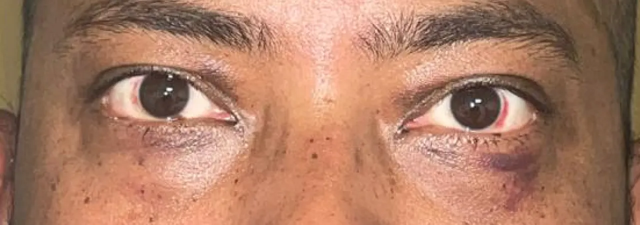 Oculofacial Aesthetics