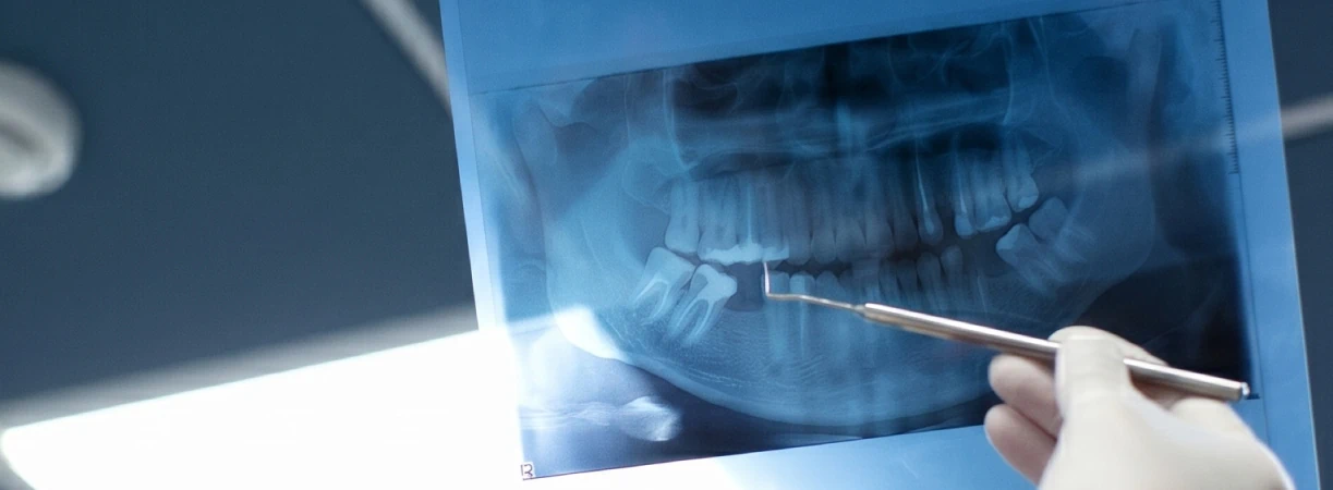 Digital X-Ray