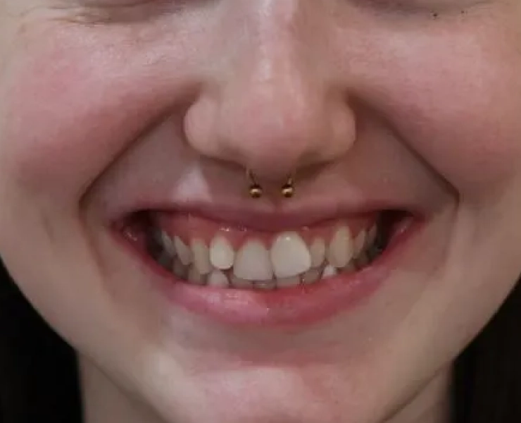main-image