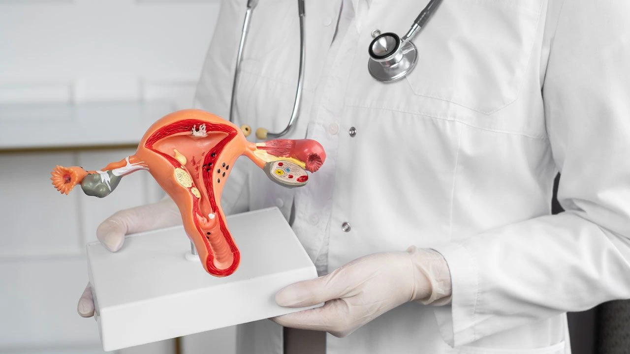 Illustration of uterus with hysteroscope removing fibroid.