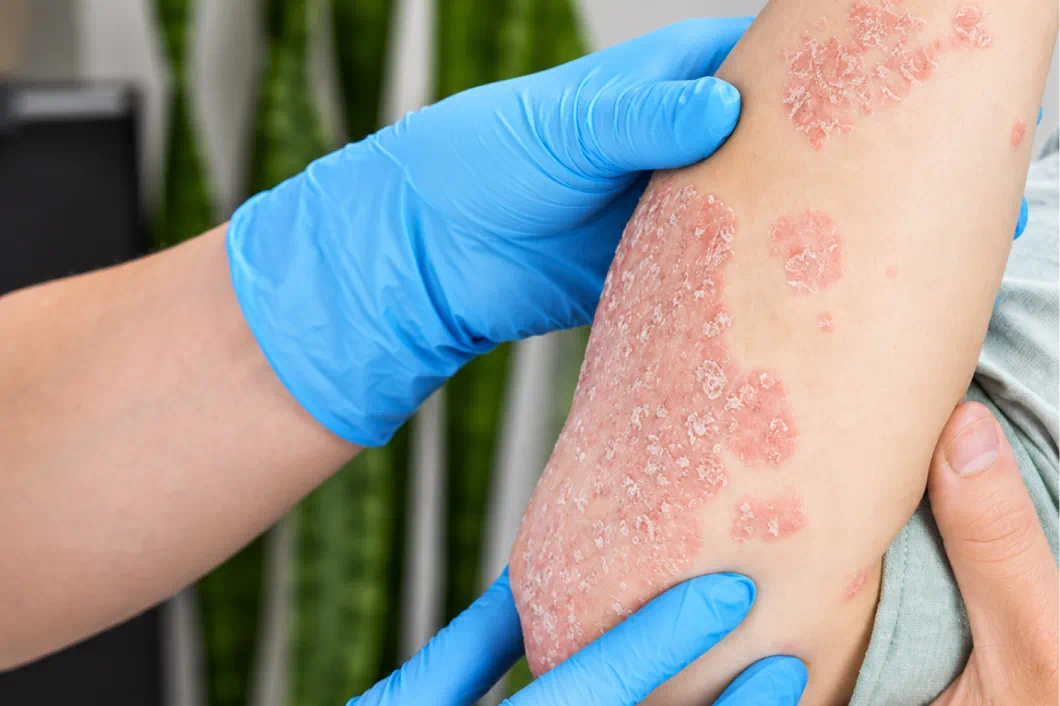Medical Dermatology