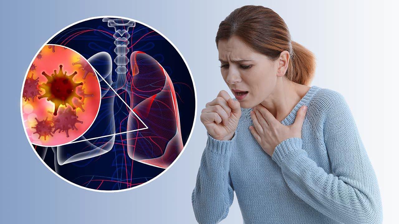 Occupational Lung Diseases