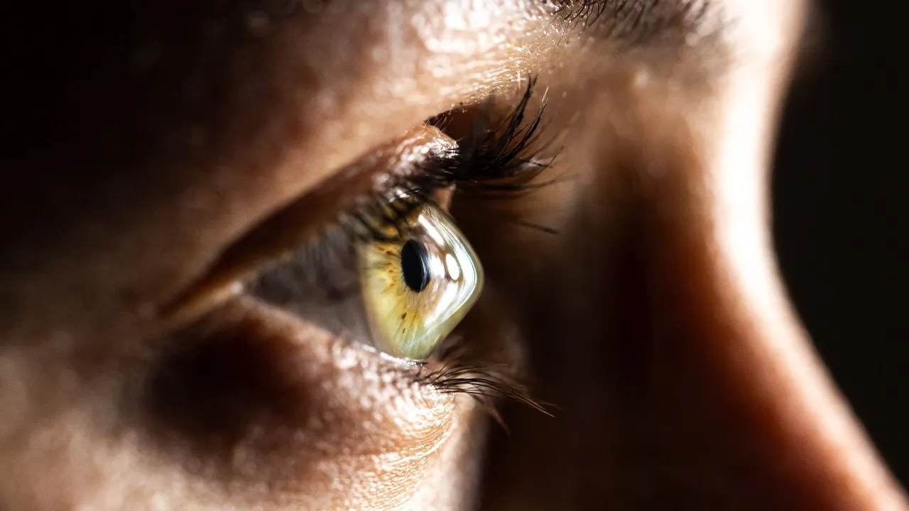 Eye specialist examining a patient with keratoconus using advanced corneal imaging technology
