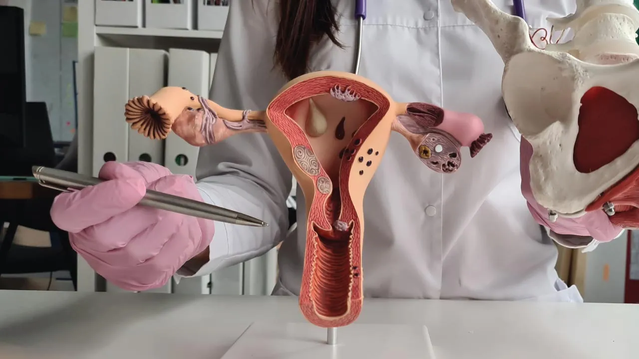 Gynecologist explaining robotic and traditional hysterectomy options to a patient using a pelvic model
