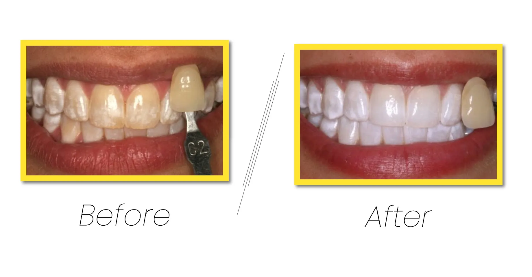 Laser Dentistry, Precision care with advanced technology.