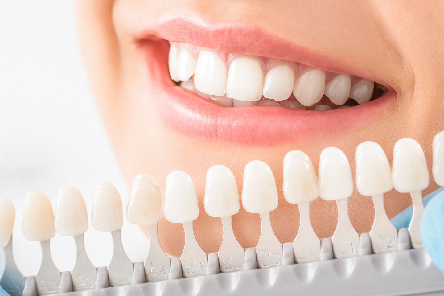 Zirconia Crown