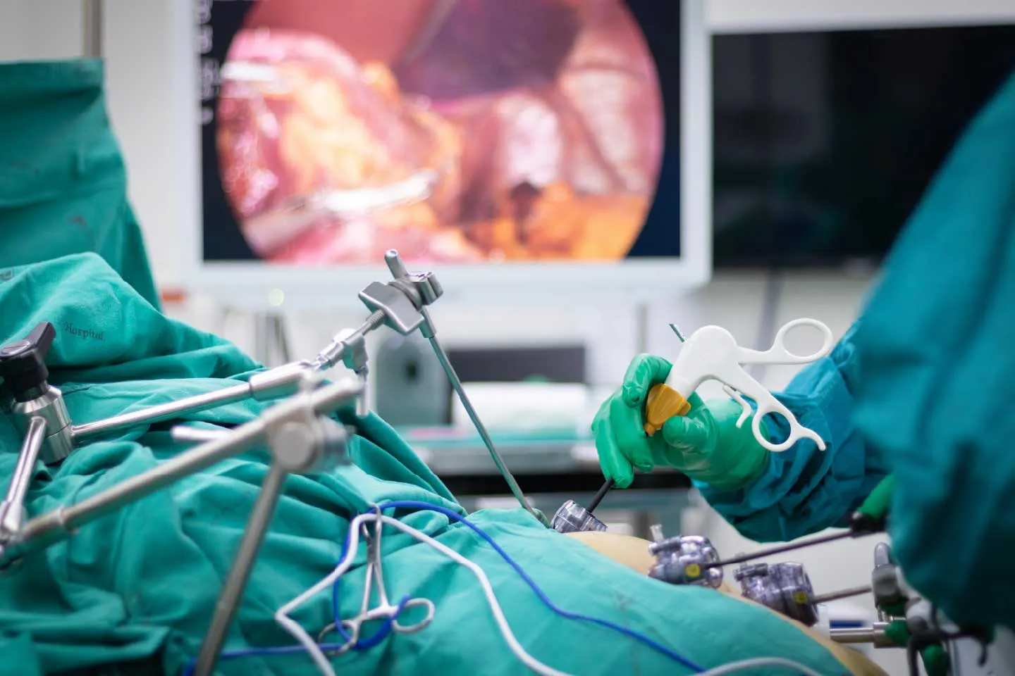 Fertility enhancing endoscopic surgery