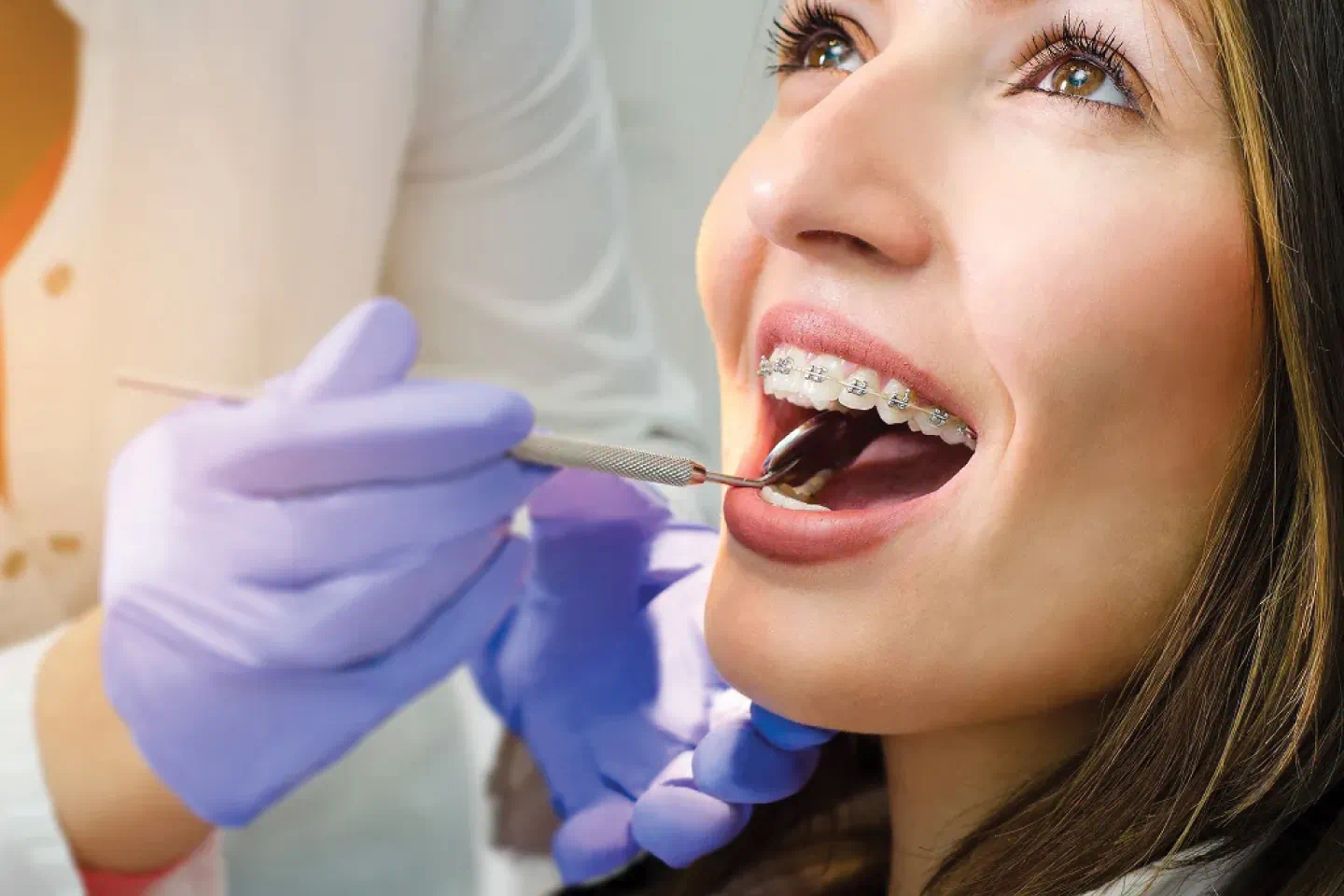 Adult Orthodontics: Invisalign vs. Braces | Buford Dental