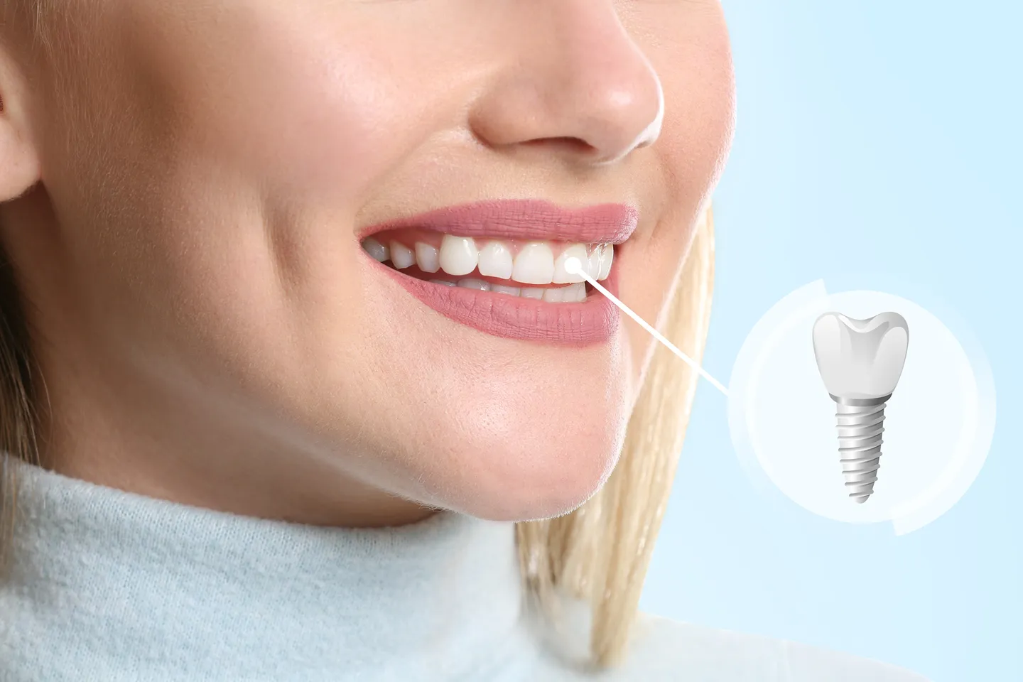 Dental Implants in Marlboro, NJ