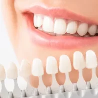Is a CEREC Crown Good for Front Teeth?