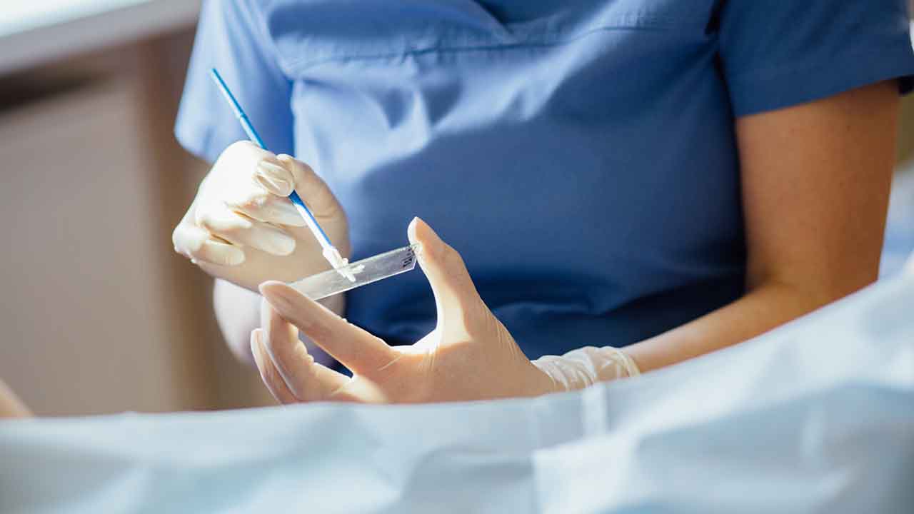 Cervical Screening Procedure Illustration