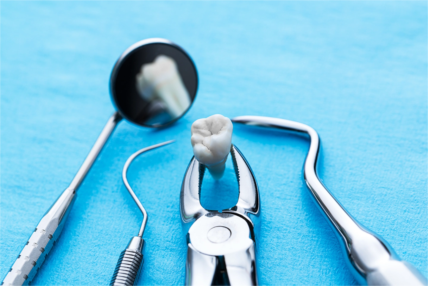 Tooth Extraction