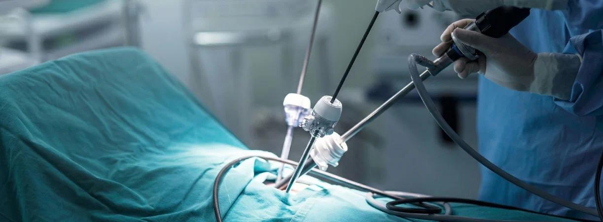 Common Conditions Treated with Laparoscopy in Women