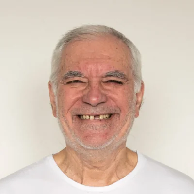Restoring Worn and Short Teeth: Dental Techniques and Treatments