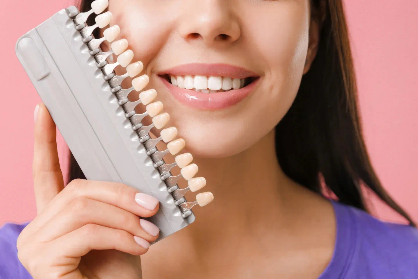 Veneers